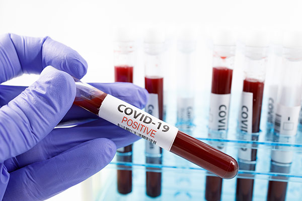 What To Do If An Employee Tests Positive For COVID-19