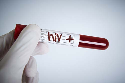 HIV Cleanup Blood