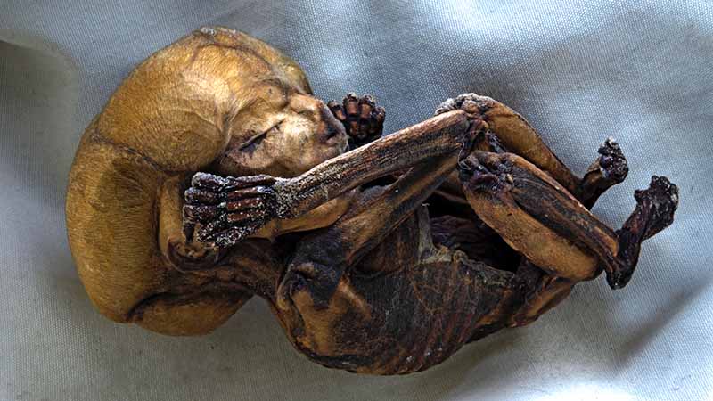 Mummified Fetus